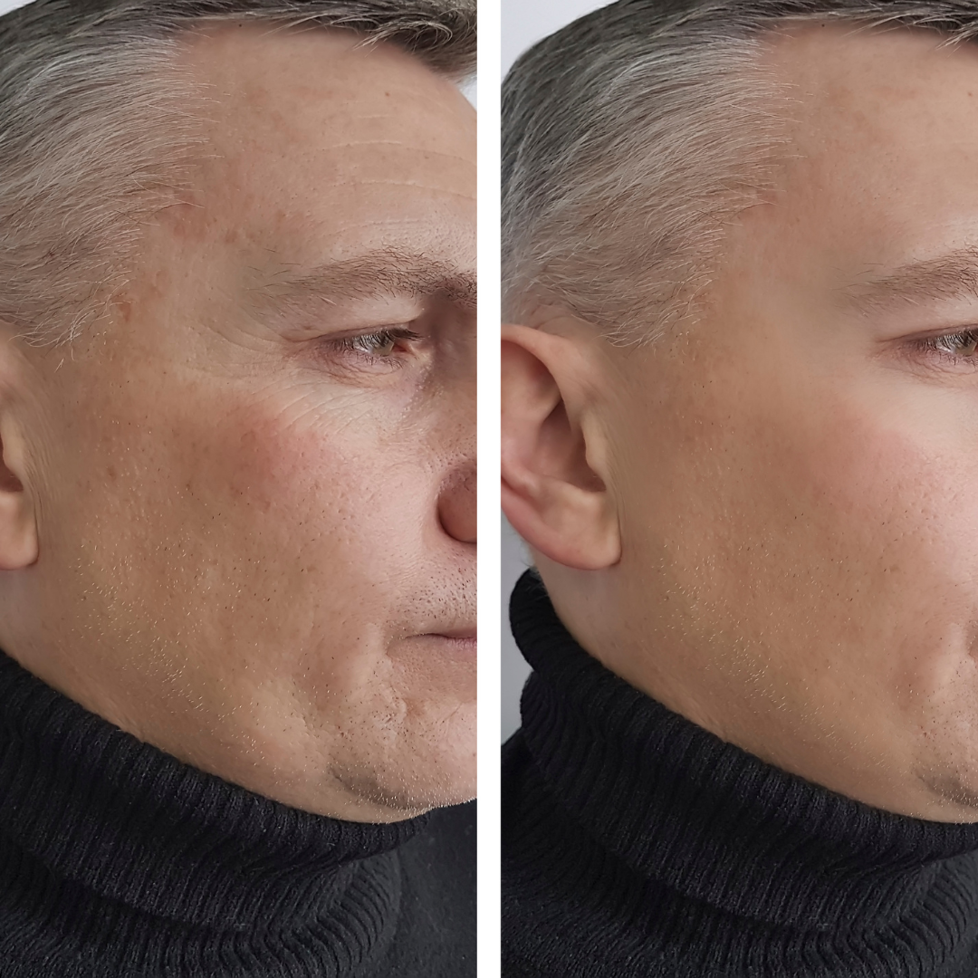 ¿Cuáles son los beneficios de usar un SUPREME SERUM?